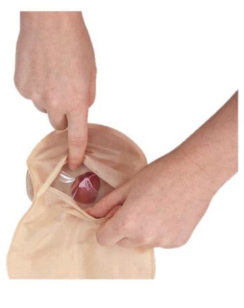 کیسه دو تکه ته باز مات,XA2D170,استومی,استوما,ایلئوستومی,کلستومی